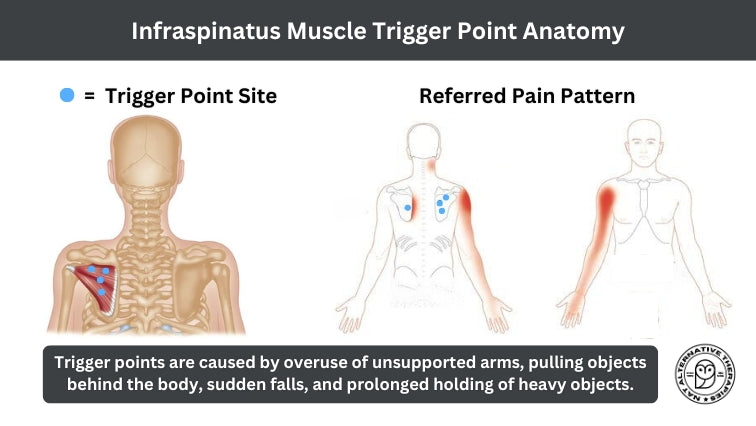 The Infraspinatus Muscle: Function, Injuries, and Treatment Modalities