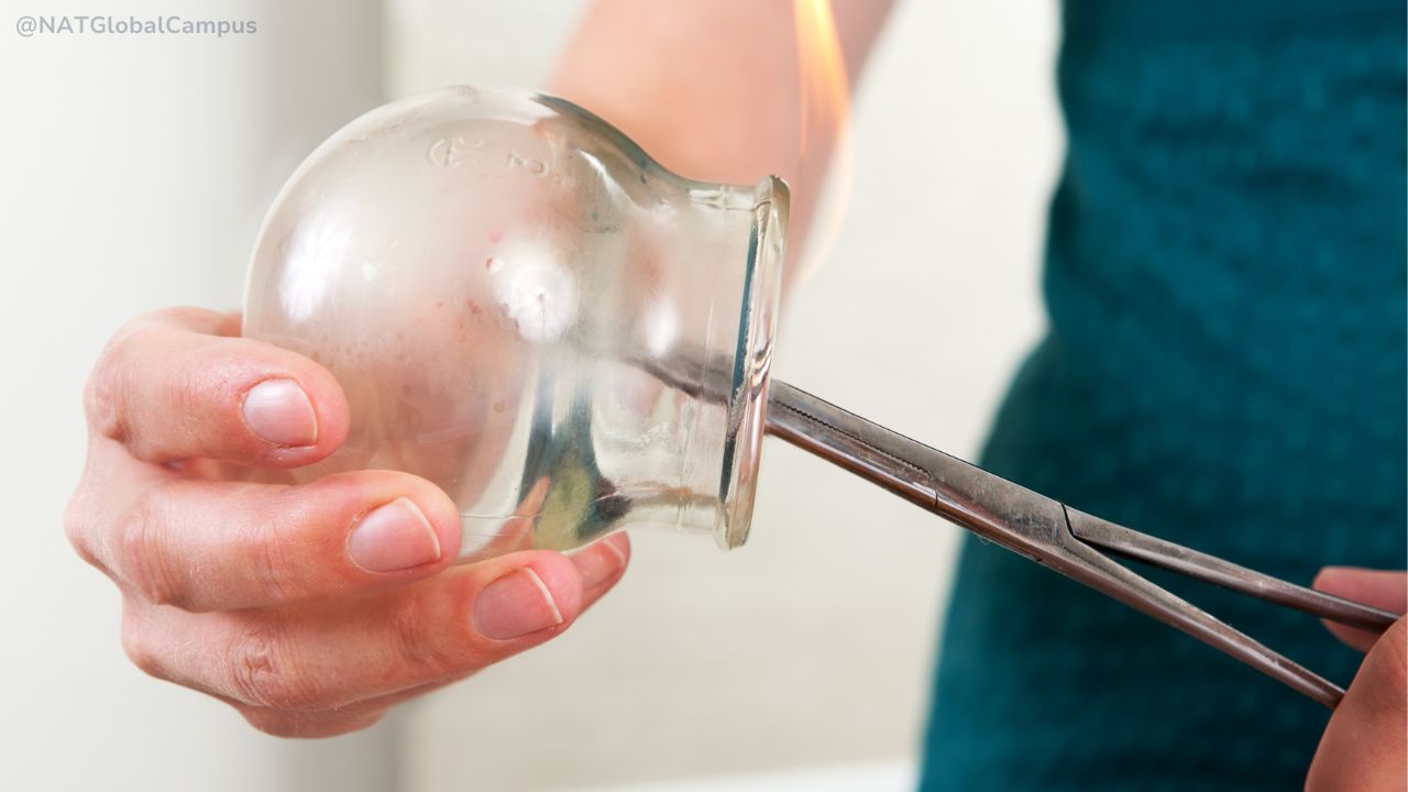 The Intriguing Art of Fire Cupping: An Ancient Healing Technique