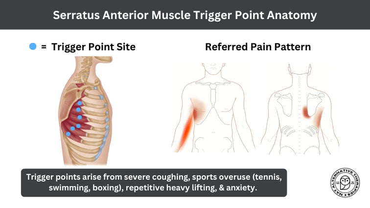 Serratus Anterior Trigger Points