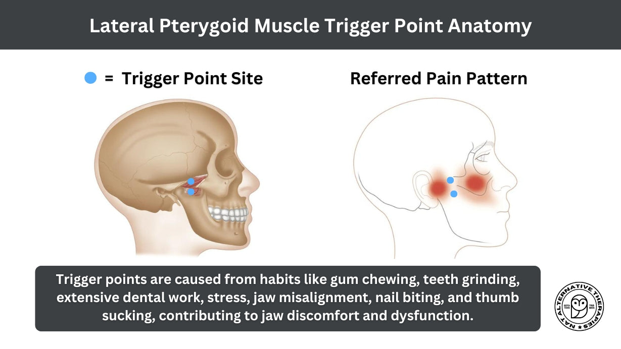 Trigger Points in the Lateral Pterygoid | Head and Jaw Pain