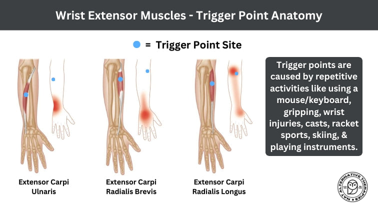 Wrist Sprains - How To Find Trigger Points