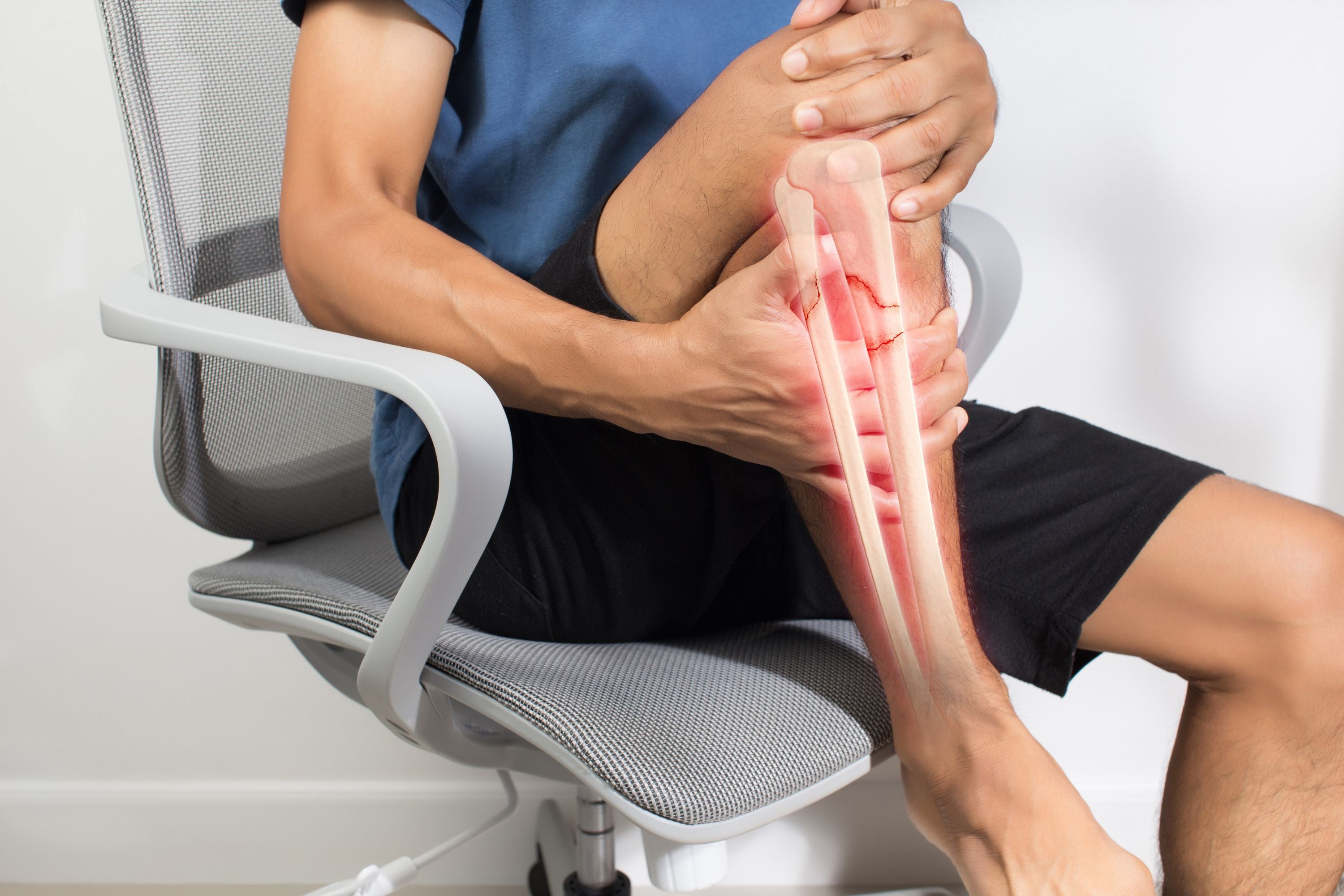 Shin Splints Tibialis Anterior