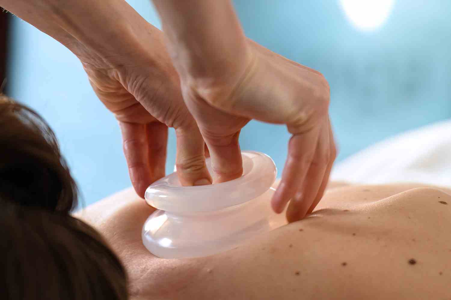 Massage Cupping
