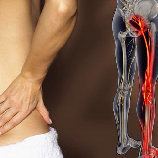 What is Appendicular Sciatica?