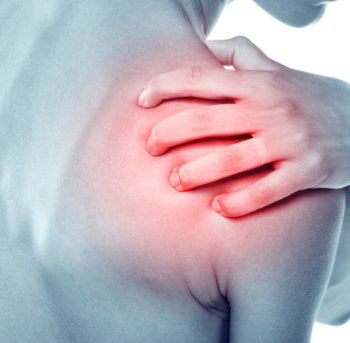 Assisted Stretching for Trigger Points - Infraspinatus