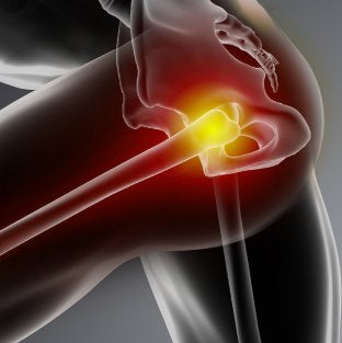 Treating Horses - Hip Pain and Dysfunction