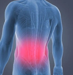 Trigger Point Therapy - Non-Specific Lower Back Pain