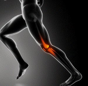 Trigger Point therapy - Taping Technique for Patellofemoral Pain Syndrome