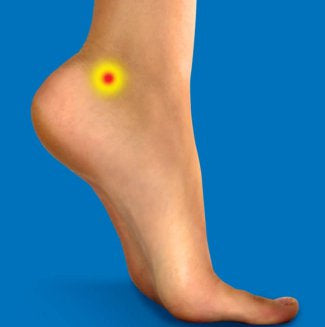 Trigger Points - Tibialis Posterior