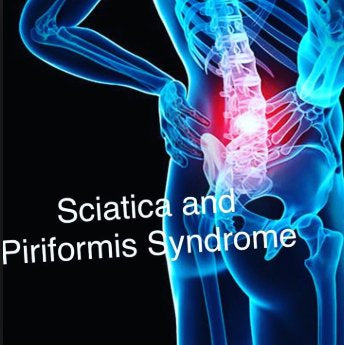 Piriformis Syndrome | Sciatic Nerve | Self Help | Manual Therapy