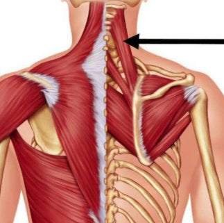 Trigger Point Therapy - Levator Scapulae (Stretch)