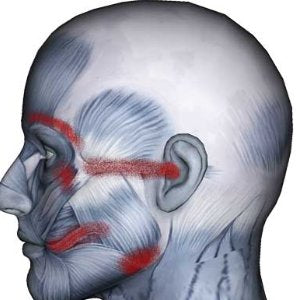 Trigger Point Therapy - Masseter