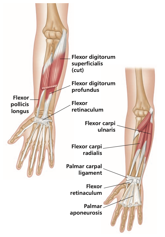 Stretching the Wrist Flexors