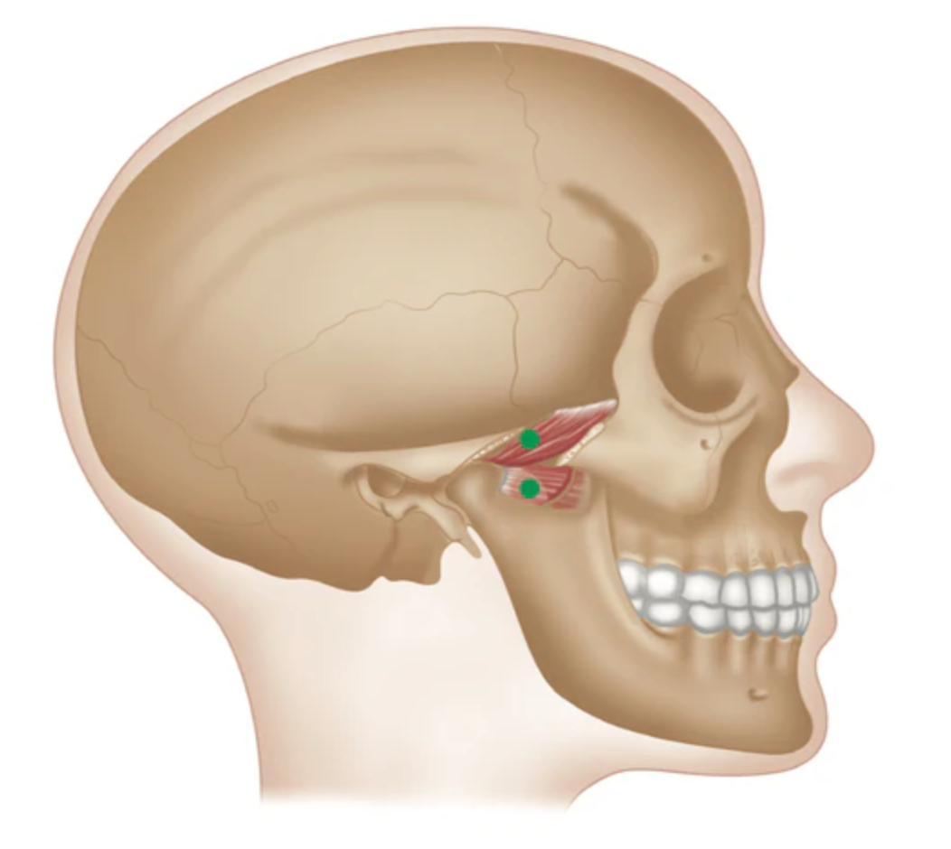 Trigger Point Therapy - Lateral Pterygoid Muscle