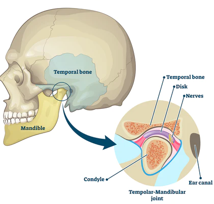 Temporomandibular Joint Disorders (TMJD) and Bruxism