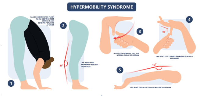 Unraveling Joint Hypermobility: A Guide for Massage Therapists
