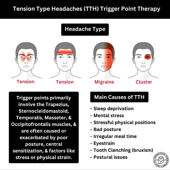 Trigger Point Therapy - Tension Type Headaches (TTH)