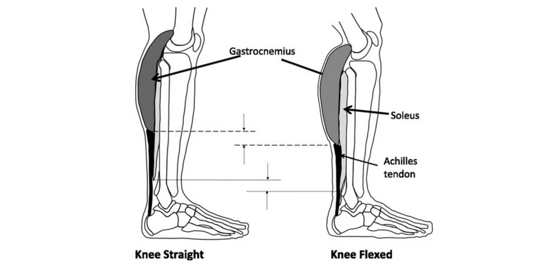 Treating Calf Muscle Strains Anatomy