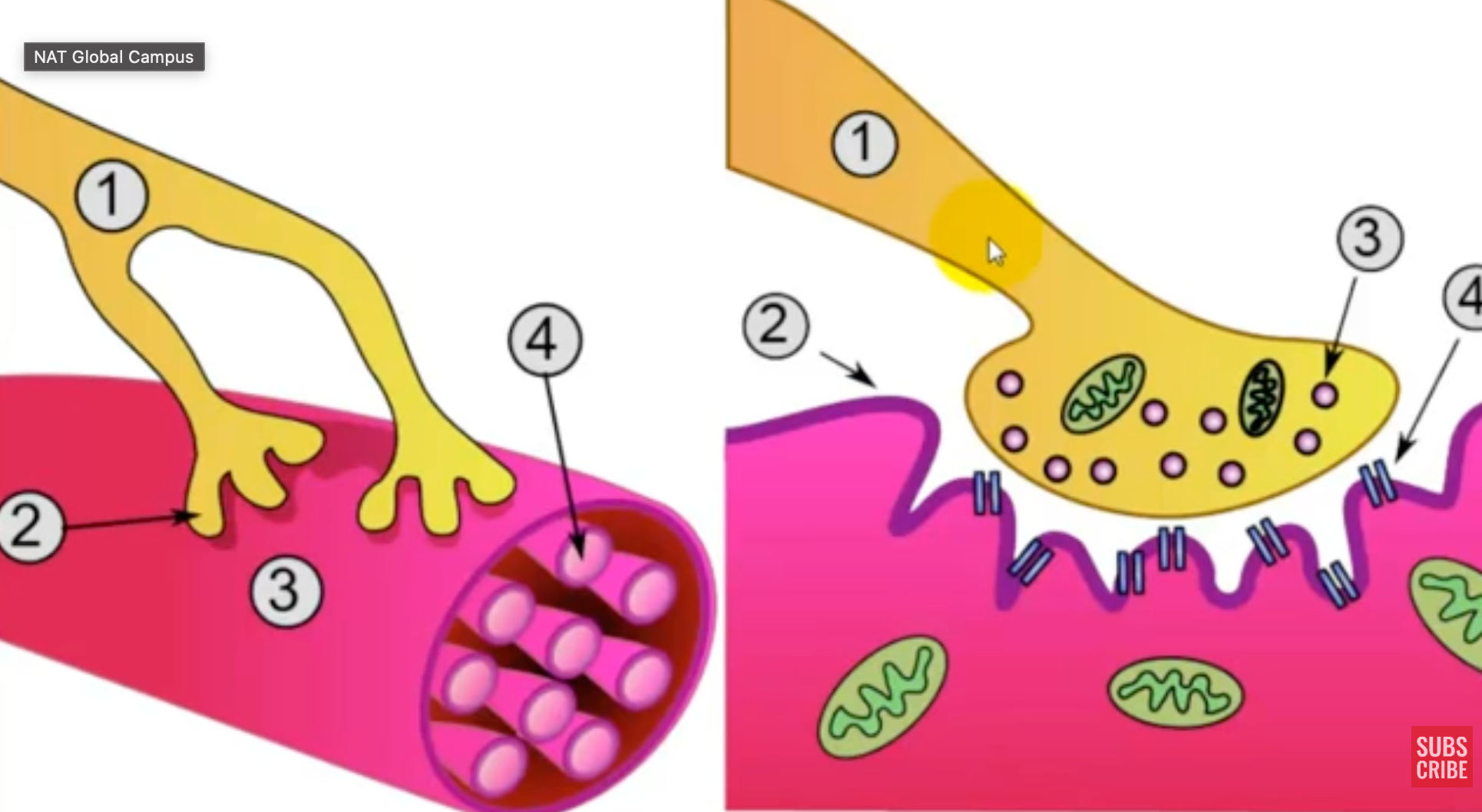 Neuroplastic Trigger Point Hypothesis