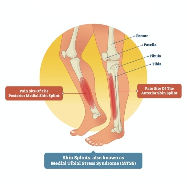 Treating Lower Limb Injuries