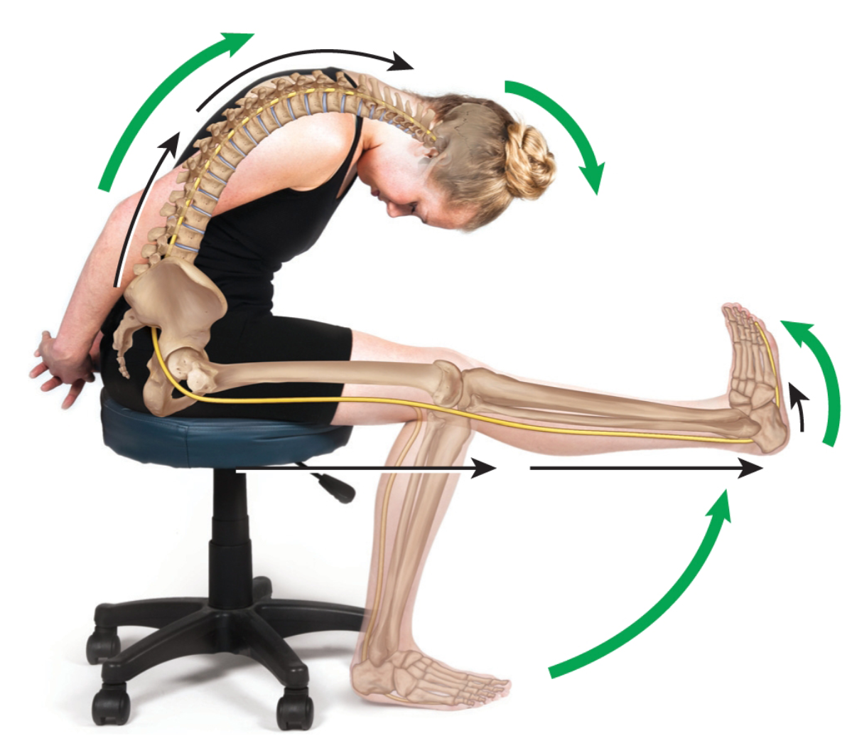 Low Back Pain - Slump Test and Nerve Flossing