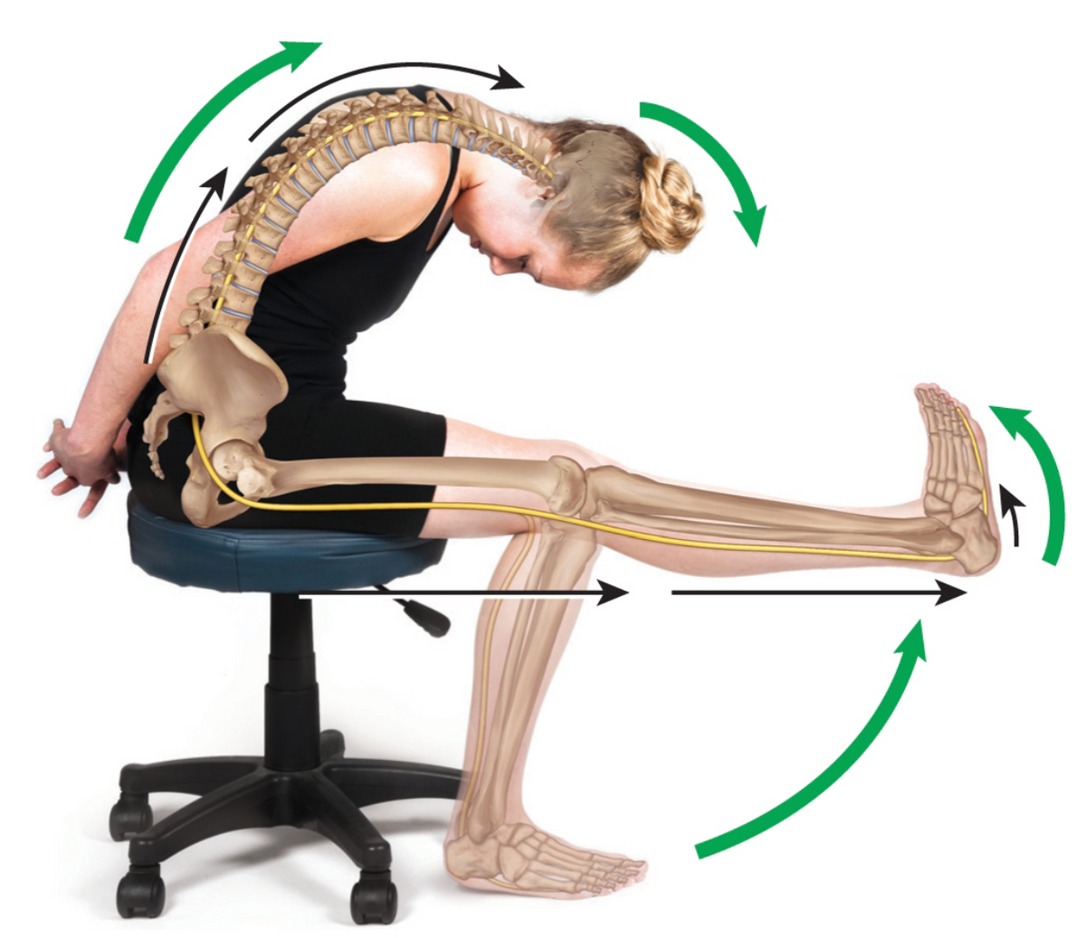 Increased neural tension in the sciatic nerve: Causes, tests, and exercises