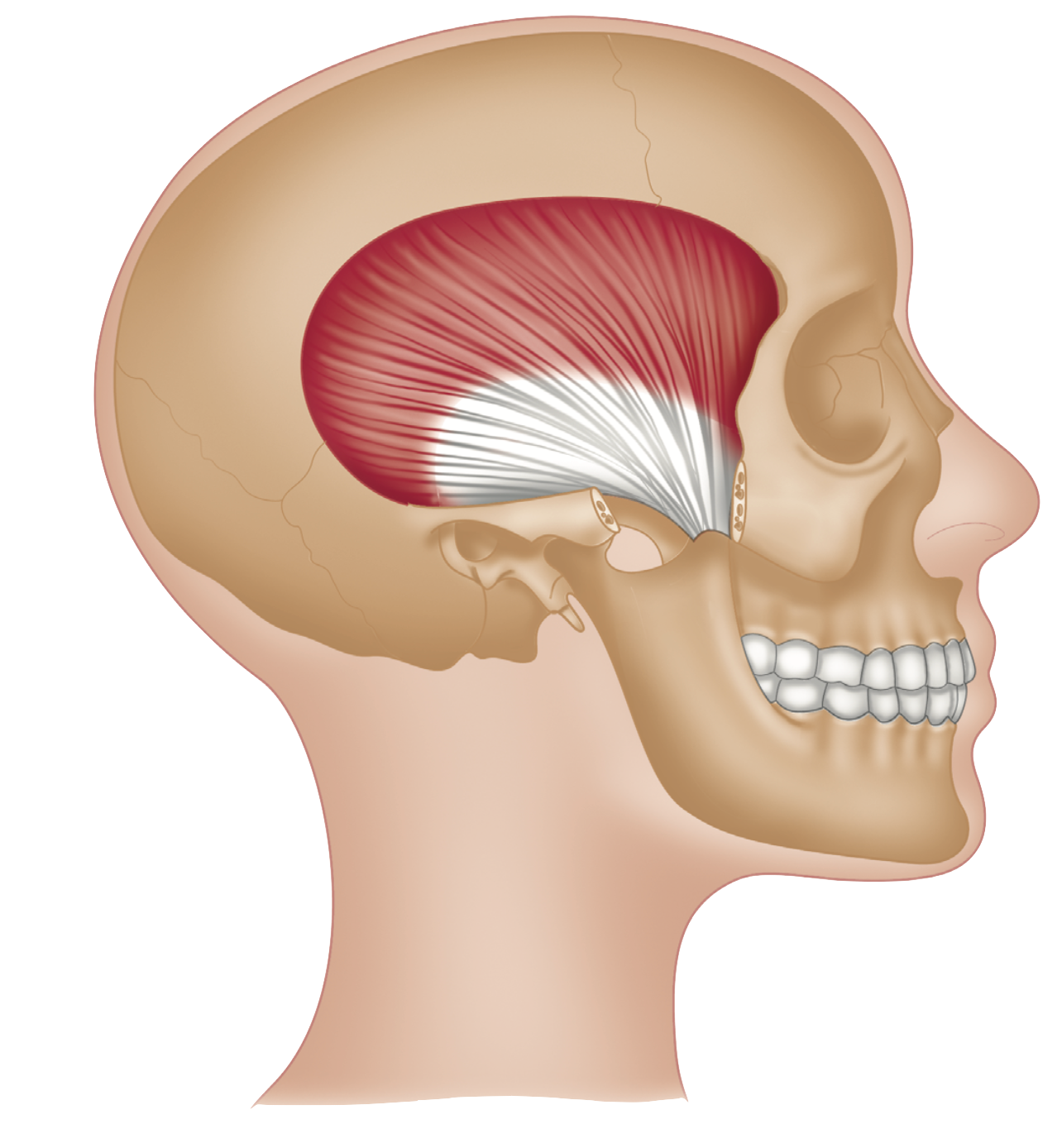 Temporalis - How to Find and Release Trigger Points