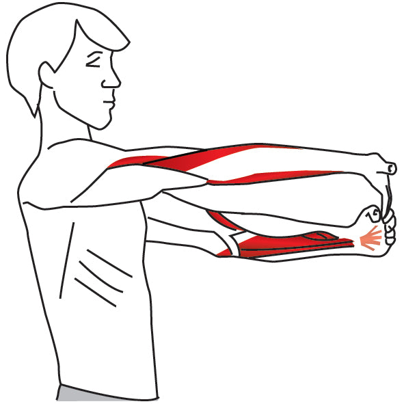 Wrist Flexor Stretch