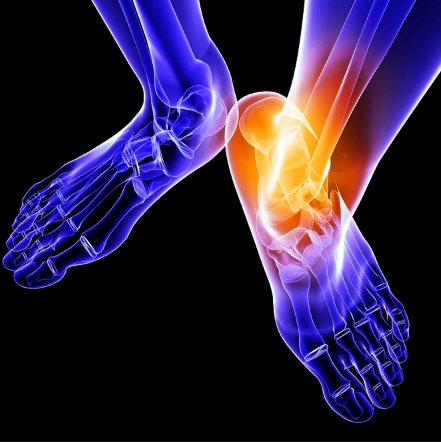 Trigger Point Therapy - Treating Ankle Sprains, Weak Ankles, and Instability