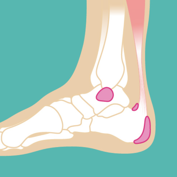 Clinical Assessment and Reasoning - Ankle Injuries
