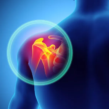 Trigger Point Therapy - Shoulder Arthritis