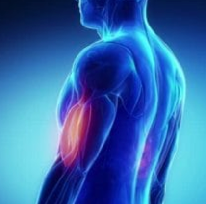 Sports Injuries - Biceps Brachii Tendon Rupture
