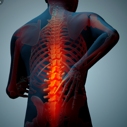 Trigger Point Therapy - Degenerative Disc Disease