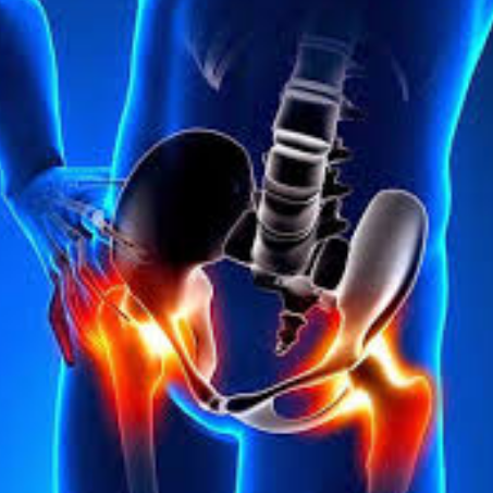 Femoral Acetabular Impingement (FAI)