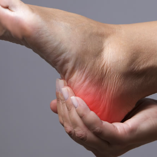 Trigger Point Therapy - Treating Plantar Fasciitis