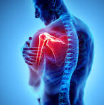 Trigger Point Therapy - Frozen Shoulder Syndrome