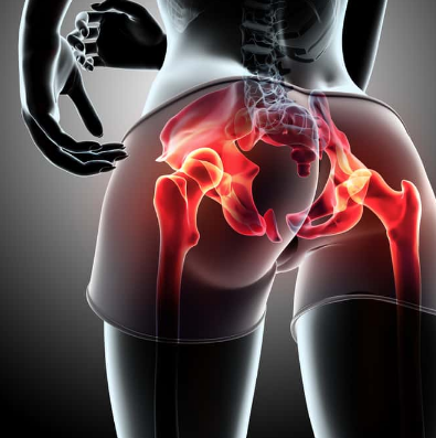 Trigger Point Therapy - Hip Pointer