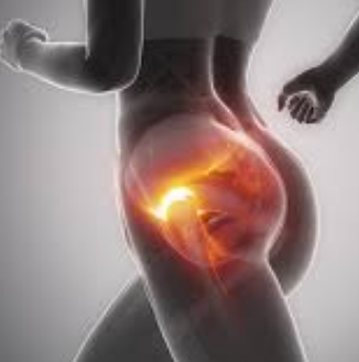 Injuries of the Hip - Trochanteric Bursitis