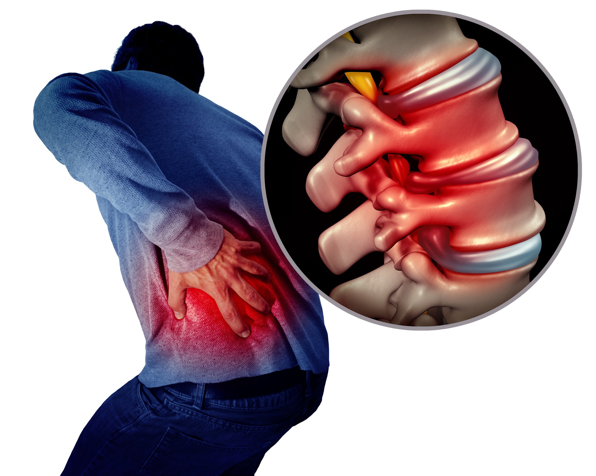 Lower Back Pain and Trigger Points