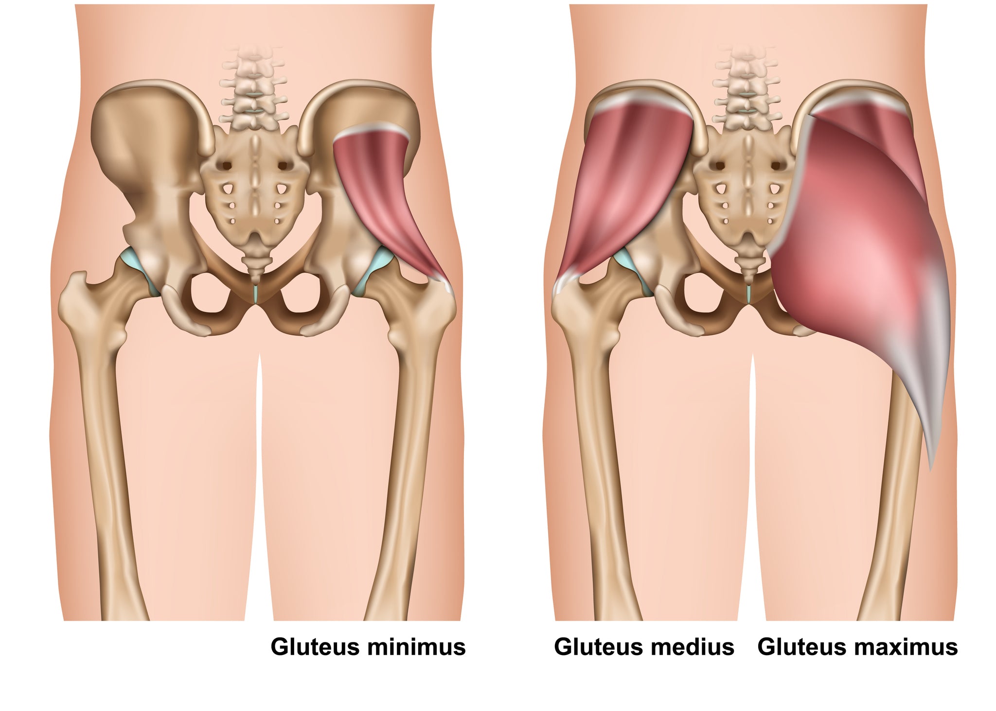 Trigger Points and Sciatic Type Pain - Gluteus Minimus