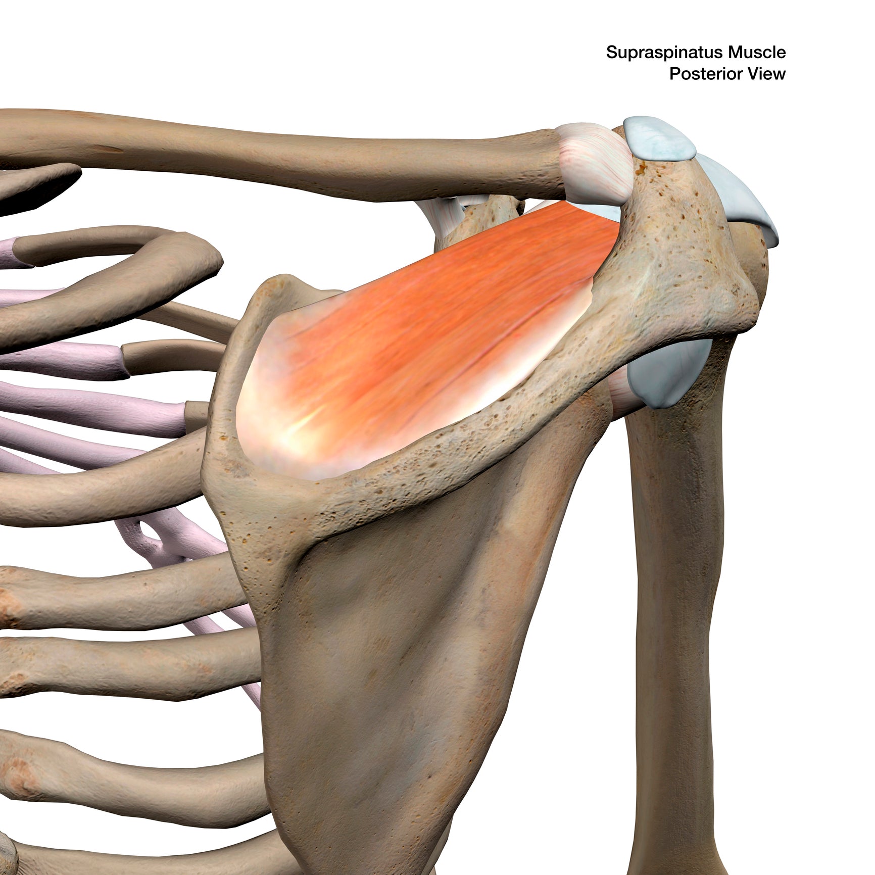 How to Treat Calcific Tendinitis