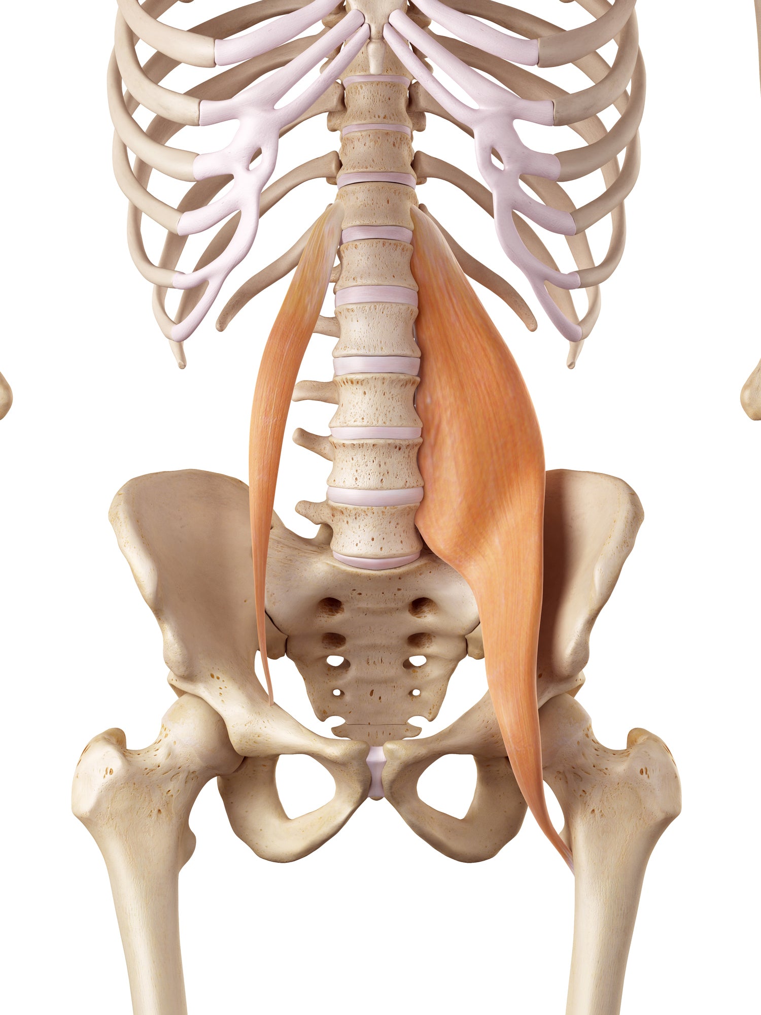 Trigger Points in the Iliopsoas Muscles (Groin Pain)