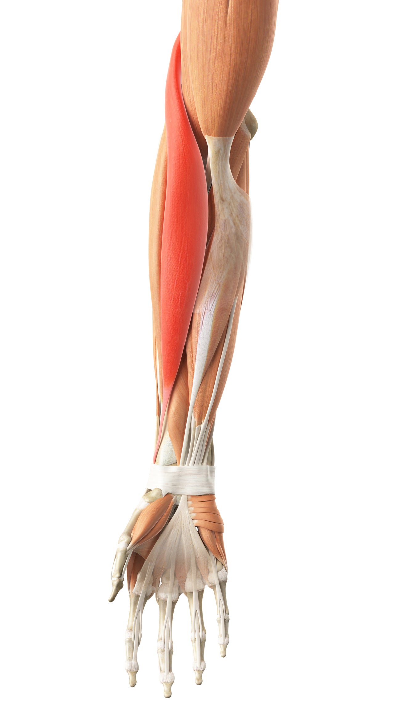 Treating the Brachioradialis Muscle