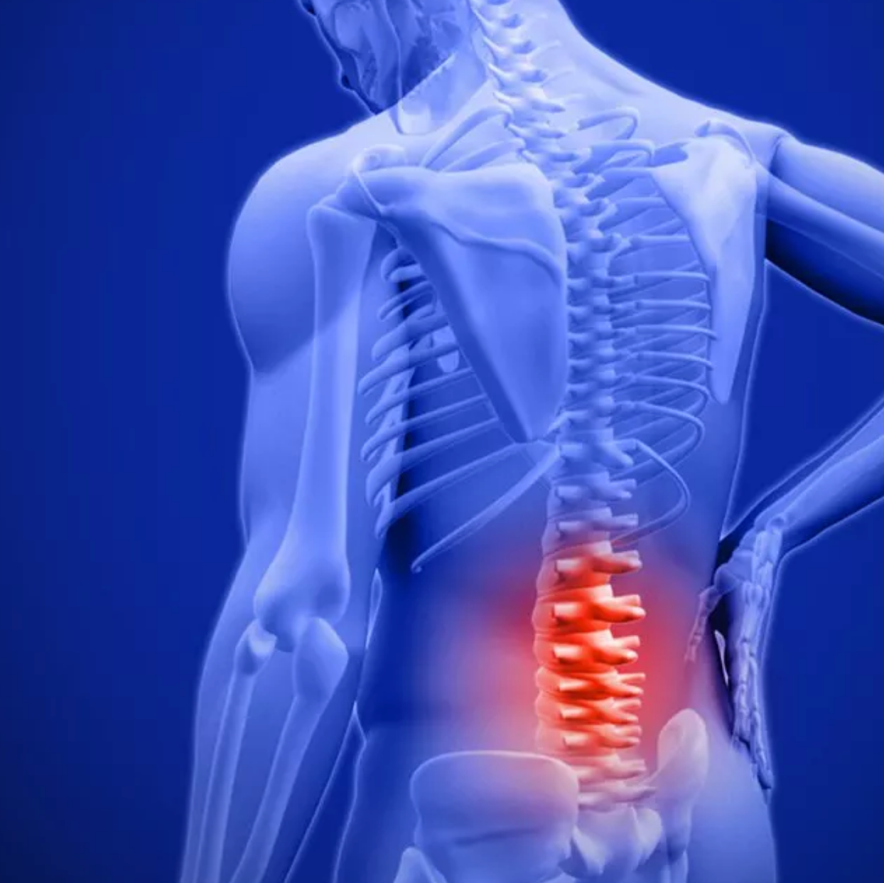 Trigger Point Therapy - Treating the Iliopsoas Group