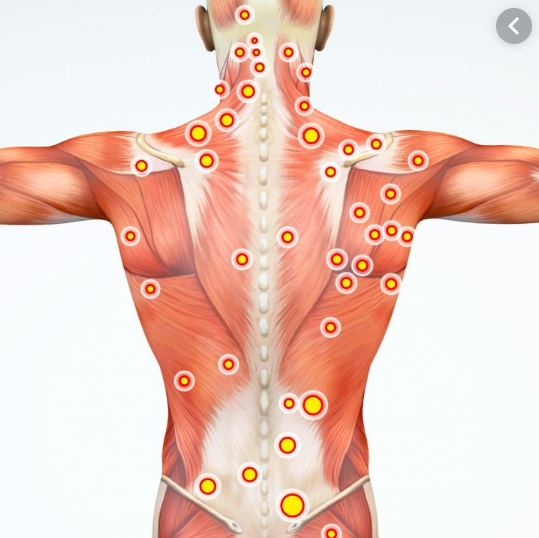 Self-Massage with Home Exercise as Treatment for Myofascial Pain Dysfunction Syndrome