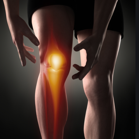 Patellofemoral Pain Syndrome (PFPS)