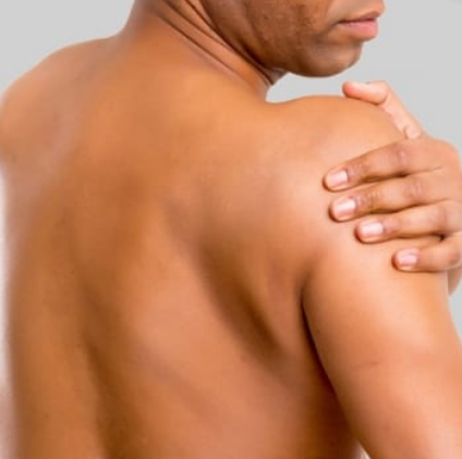 Trigger Point Therapy - Shoulder Bursitis