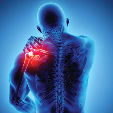 NAT Trigger Point Workshop - Treating The Complex Shoulder