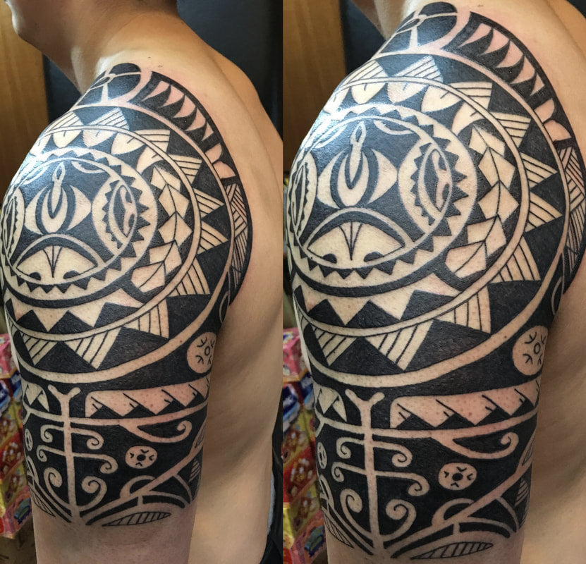 Massage Cupping for Muscle Adhesions and Scarring Caused by Tattoos