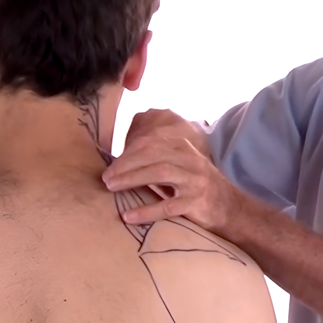 Tension Headache and Trigger Points (4 hrs)